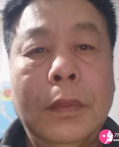 付会奇