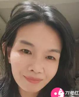 绿奴