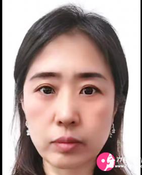 半山之境